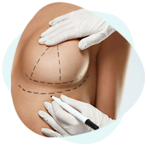 procedimentos-e-cirurgias-mastopexia